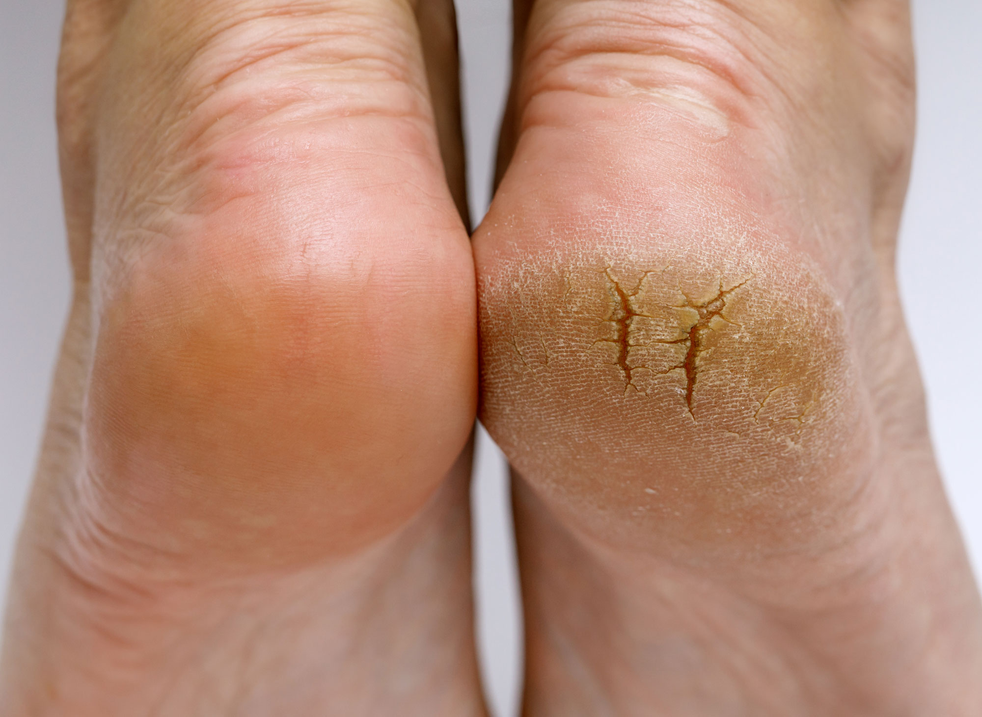luxefeet-podiatry-help luxefeet-laser-therapy