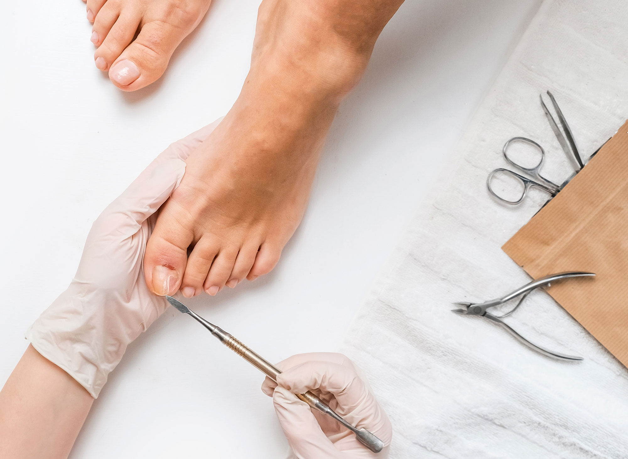 luxefeet-specialised luxefeet-laser-therapy