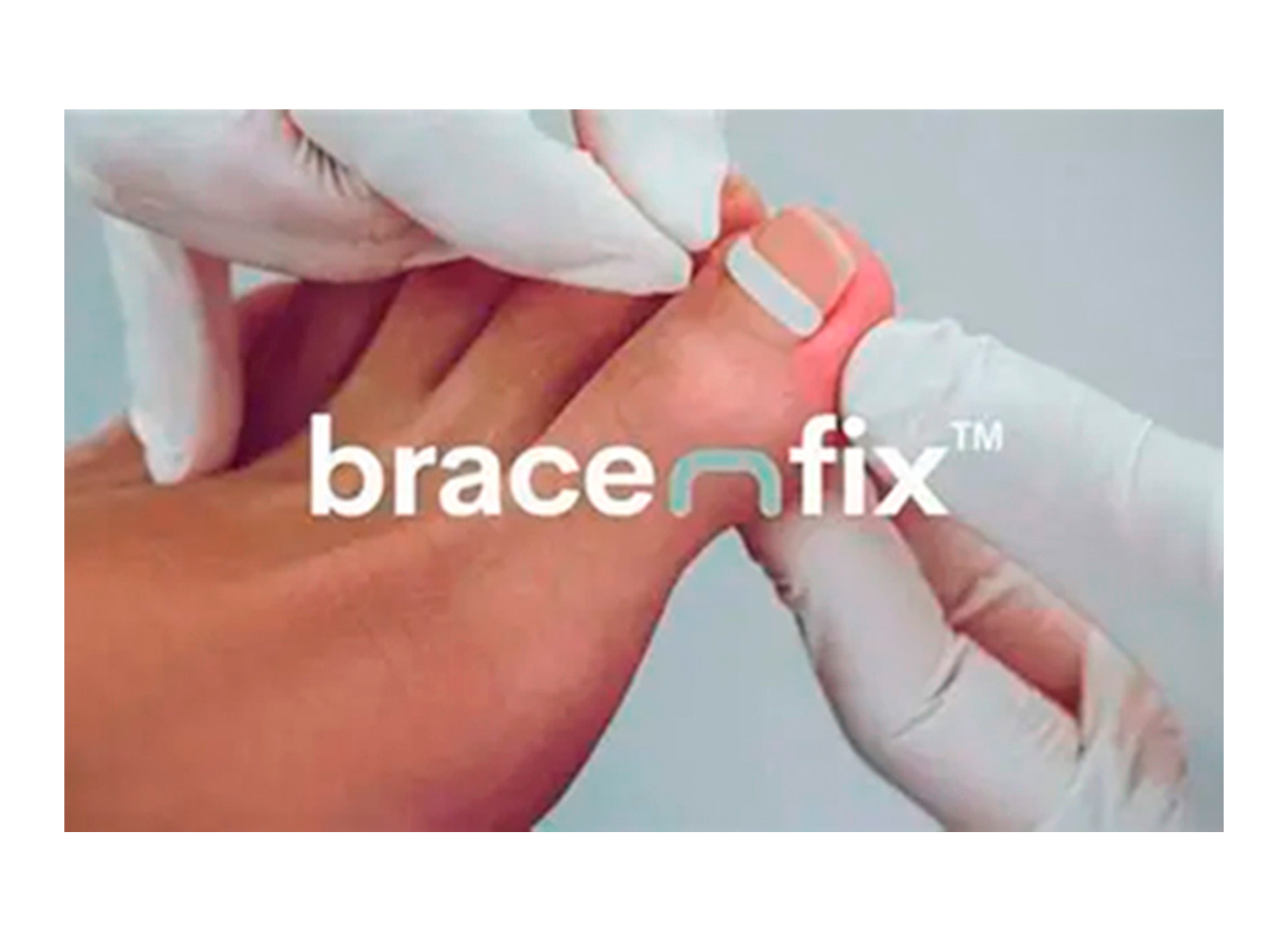 Image-bracenfix luxefeet-nail-restoration