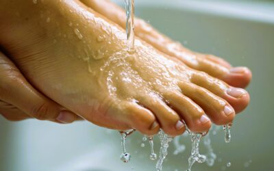 More Than Just Sweaty Feet: Understanding Hyperhidrosis and Why You Don’t Have to Live With It